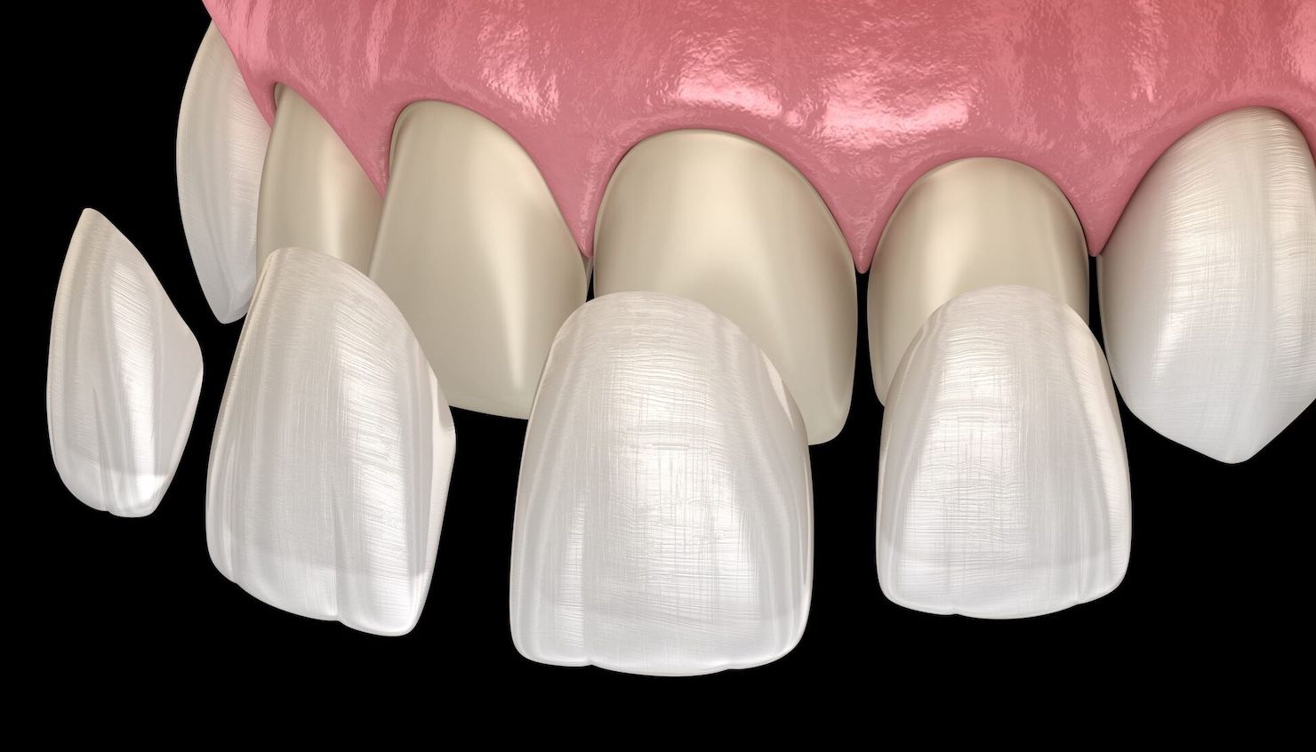 service illustration